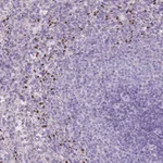 Atlas Antibodies Anti-ADCY7 Antibody