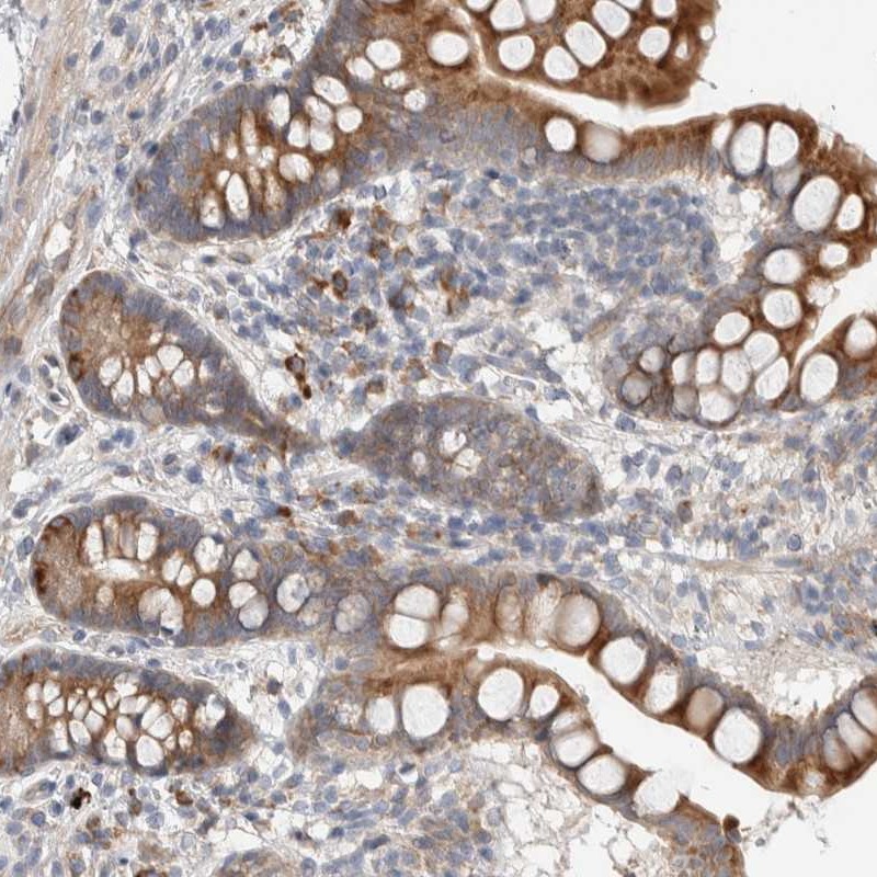 Atlas Antibodies Anti-ADCY8 Antibody