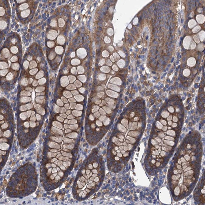 Atlas Antibodies Anti-ADCY9 Antibody
