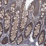 Atlas Antibodies Anti-ADCY9 Antibody