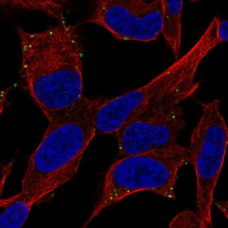 Atlas Antibodies Anti-ADCYAP1R1 Antibody