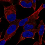 Atlas Antibodies Anti-ADCYAP1R1 Antibody