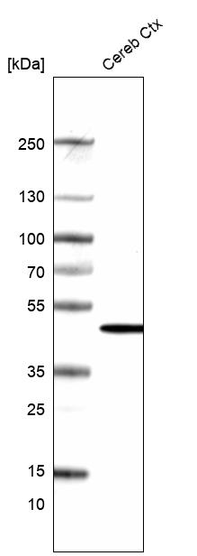Atlas Antibodies Anti-ADCYAP1R1 Antibody