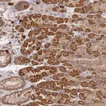 Atlas Antibodies Anti-ADCY9 Antibody