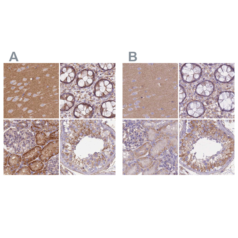 Atlas Antibodies Anti-ADD1 Antibody
