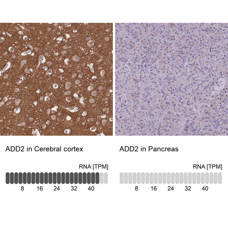 Atlas Antibodies Anti-ADD2 Antibody
