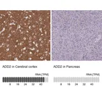 Atlas Antibodies Anti-ADD2 Antibody