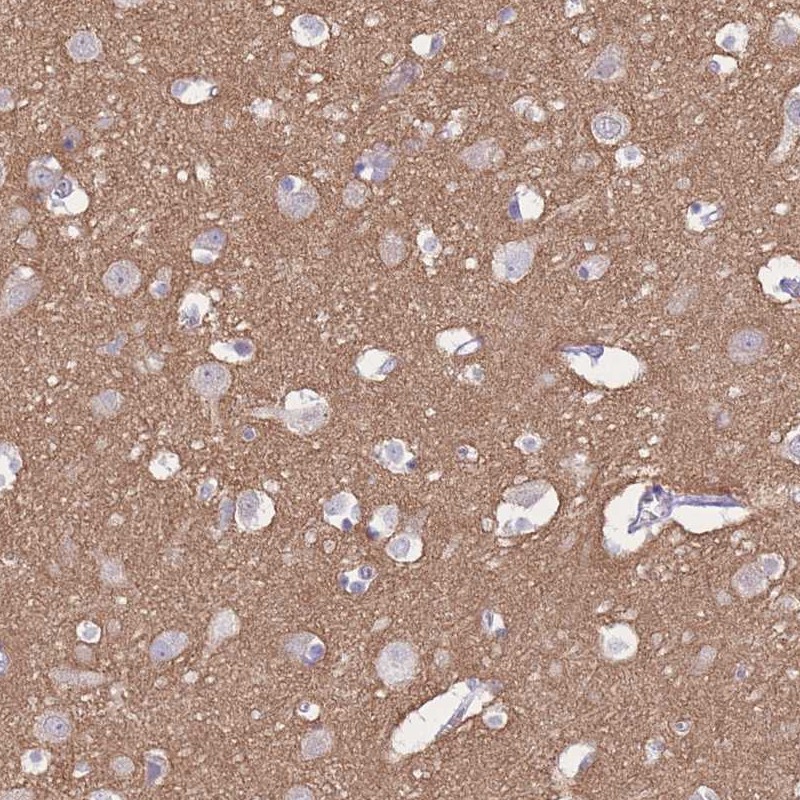 Atlas Antibodies Anti-ADD2 Antibody