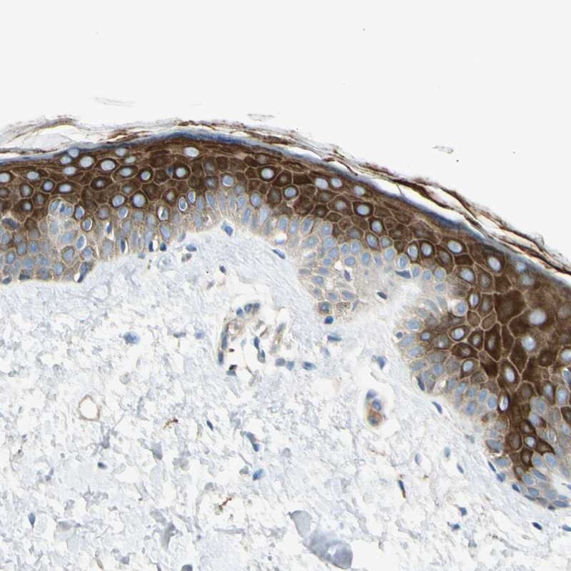 Atlas Antibodies Anti-ADGRA3 Antibody