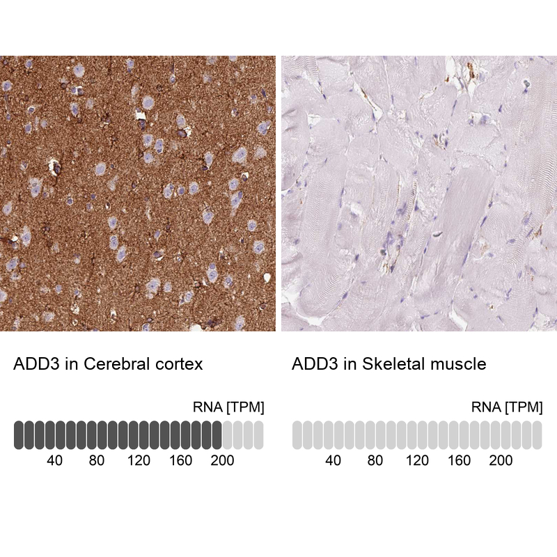 Atlas Antibodies Anti-ADD3 Antibody