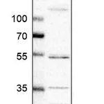 Atlas Antibodies Anti-ADGRB2 Antibody
