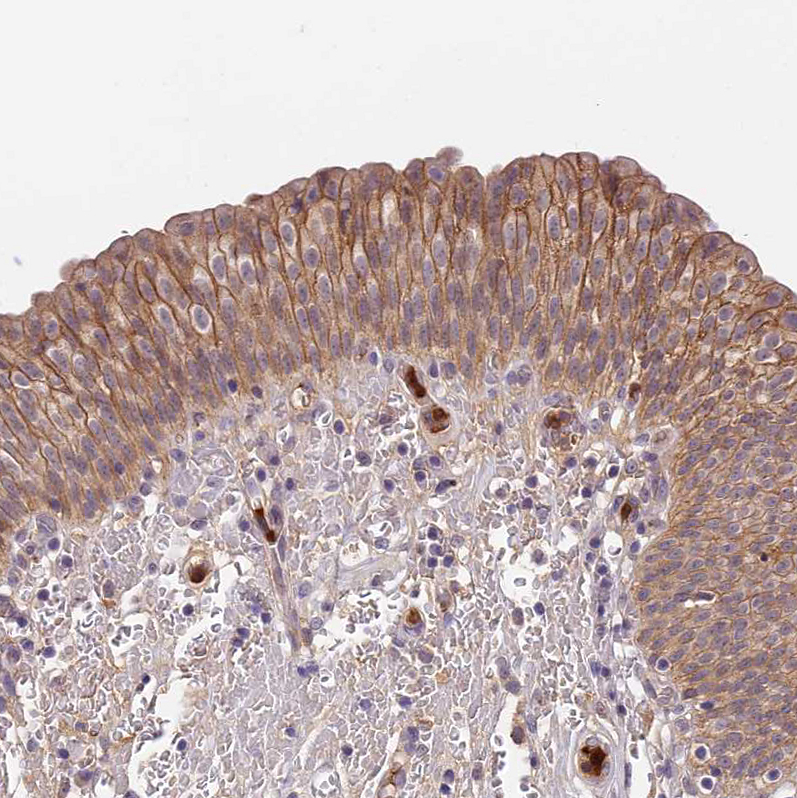 Atlas Antibodies Anti-ADGRD1 Antibody