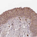 Atlas Antibodies Anti-ADGRD1 Antibody