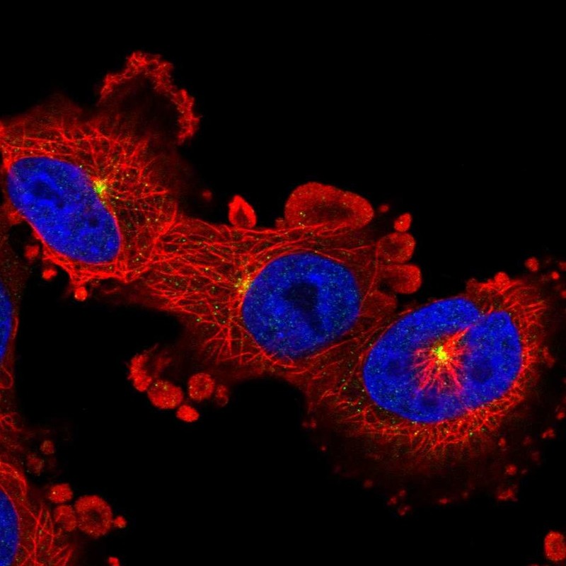 Atlas Antibodies Anti-ADGRB2 Antibody