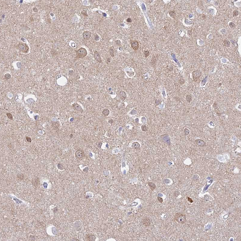 Atlas Antibodies Anti-ADGRA1 Antibody