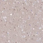 Atlas Antibodies Anti-ADGRA1 Antibody