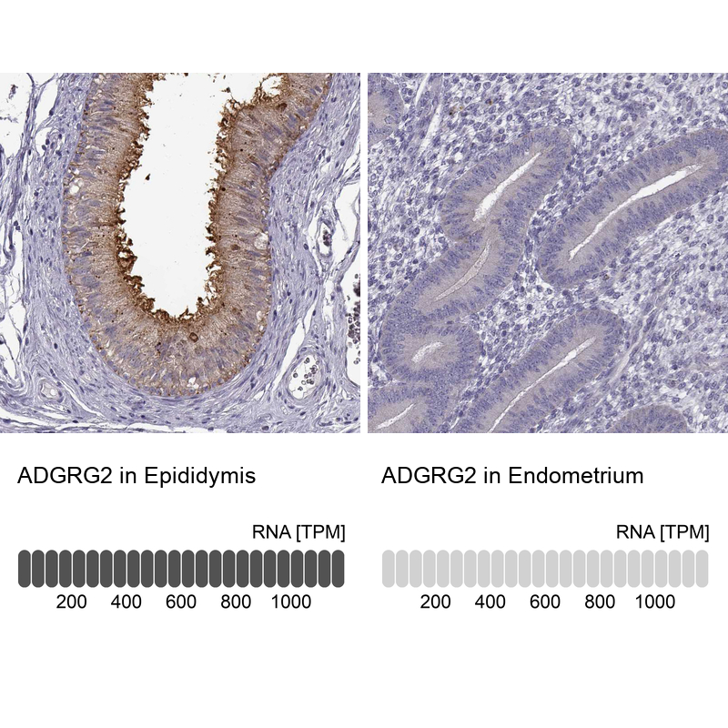 Atlas Antibodies Anti-ADGRG2 Antibody
