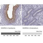 Atlas Antibodies Anti-ADGRG2 Antibody