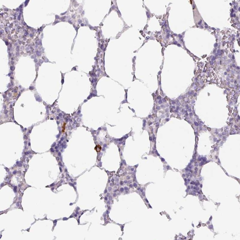Atlas Antibodies Anti-ADGRE1 Antibody