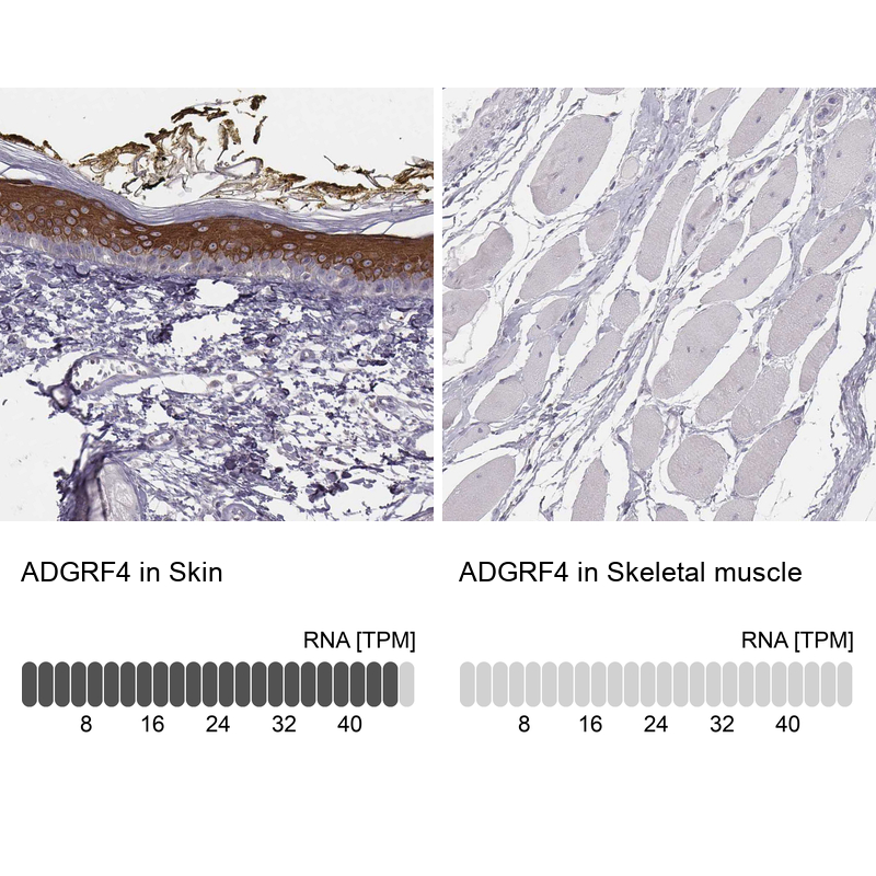 Atlas Antibodies Anti-ADGRF4 Antibody