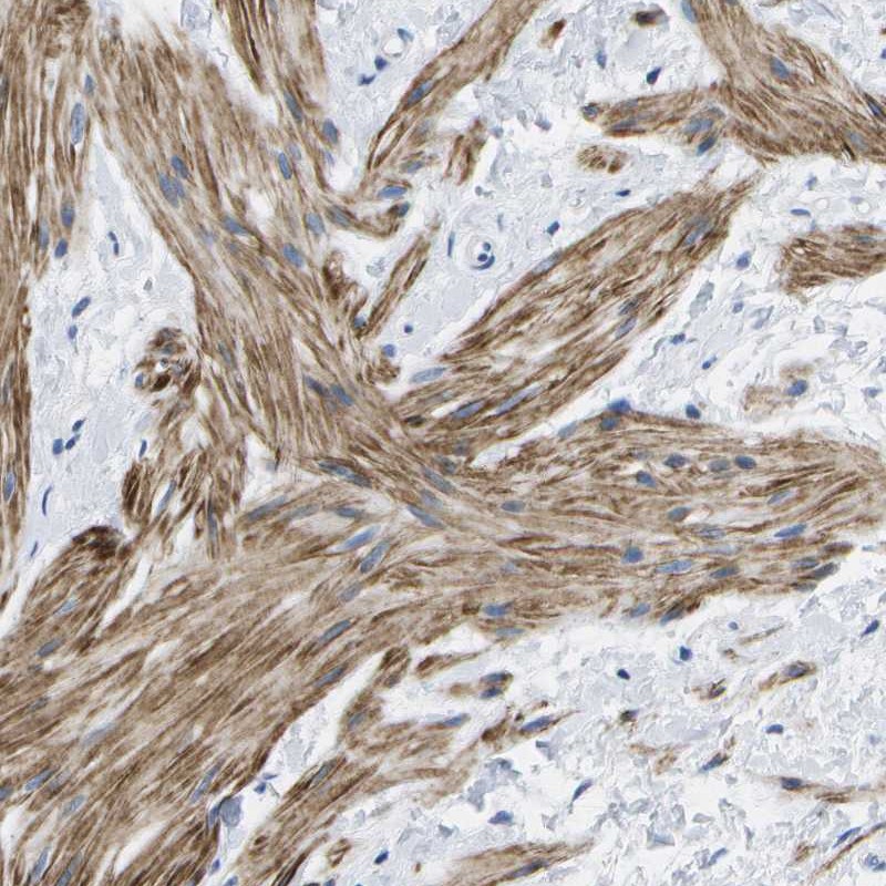 Atlas Antibodies Anti-ADGRG6 Antibody