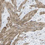 Atlas Antibodies Anti-ADGRG6 Antibody