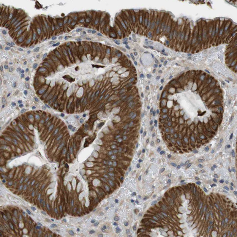 Atlas Antibodies Anti-ADGRL3 Antibody