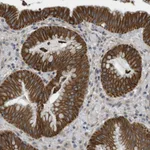 Atlas Antibodies Anti-ADGRL3 Antibody