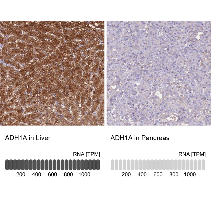 Atlas Antibodies Anti-ADH1A Antibody