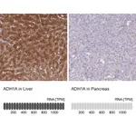 Atlas Antibodies Anti-ADH1A Antibody