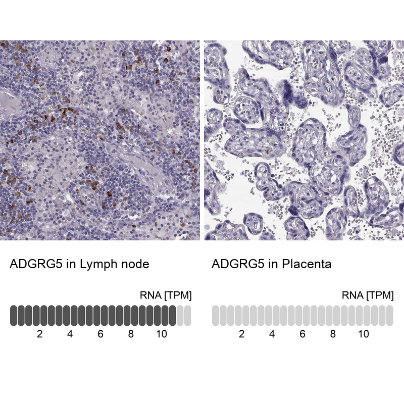 Atlas Antibodies Anti-ADGRG5 Antibody