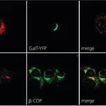 Merck ANTI-ERGIC-53/P58