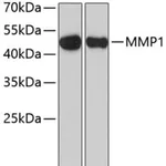 Merck ANTI-MMP1 ANTIBODY PRODUCED IN RABBIT