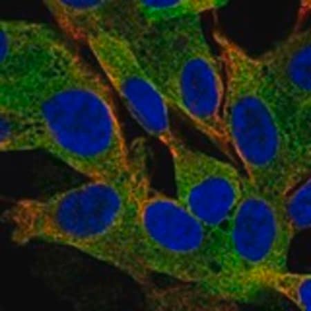 Merck Anti-MAP2 antibody produced in rabbit