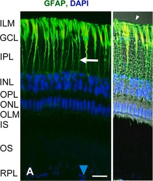 Merck ANTI-GLIAL FIBRILLARY ACIDIC PROTEIN&