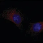 Merck ANTI-LRP1 (N-TERMINAL)