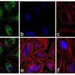 Thermo Fisher Scientific Donkey anti-Rabbit IgG (H+L) Cross-Adsorbed Secondary Antibody, DyLight 488