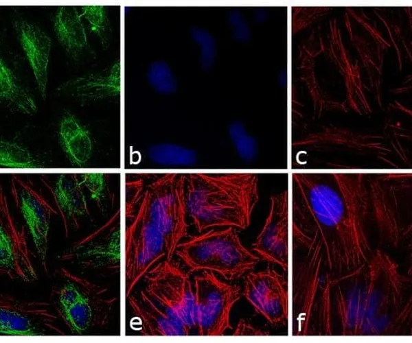 Thermo Fisher Scientific Donkey anti-Rabbit IgG (H+L) Cross-Adsorbed Secondary Antibody, DyLight 488