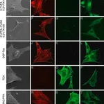 Merck MOUSE MONOCLONAL ANTI-BETA-TUBULIN CLON&