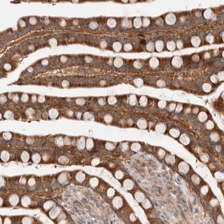 Merck Anti-SLC29A1 antibody produced in rabbit