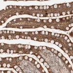 Merck Anti-SLC29A1 antibody produced in rabbit