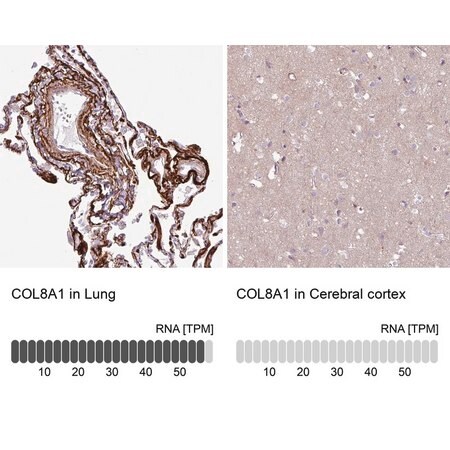 Merck Anti-COL8A1 antibody produced in rabbit