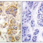 Merck ANTI-COLLAGEN I ANTIBODY PROD IN RAB