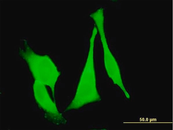 Merck Monoclonal Anti-FZD3 antibody produced in mouse