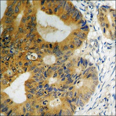 Merck Anti-phospho-CaMK2 (pThr286) antibody produced in rabbit
