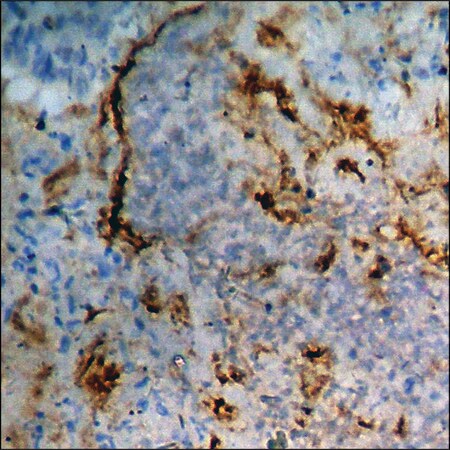Merck Anti-phospho-Calcium Sensing Receptor (pThr888) antibody produced in rabbit