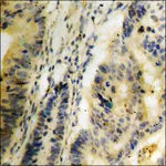 Merck Anti-phospho-Trk C (pTyr516) antibody produced in rabbit
