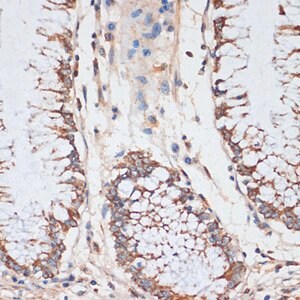 Merck ANTI-CDK4 ANTIBODY PRODUCED IN RABBIT
