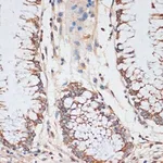 Merck ANTI-CDK4 ANTIBODY PRODUCED IN RABBIT