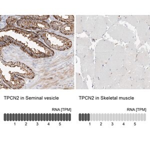 Merck ANTI-TPCN2